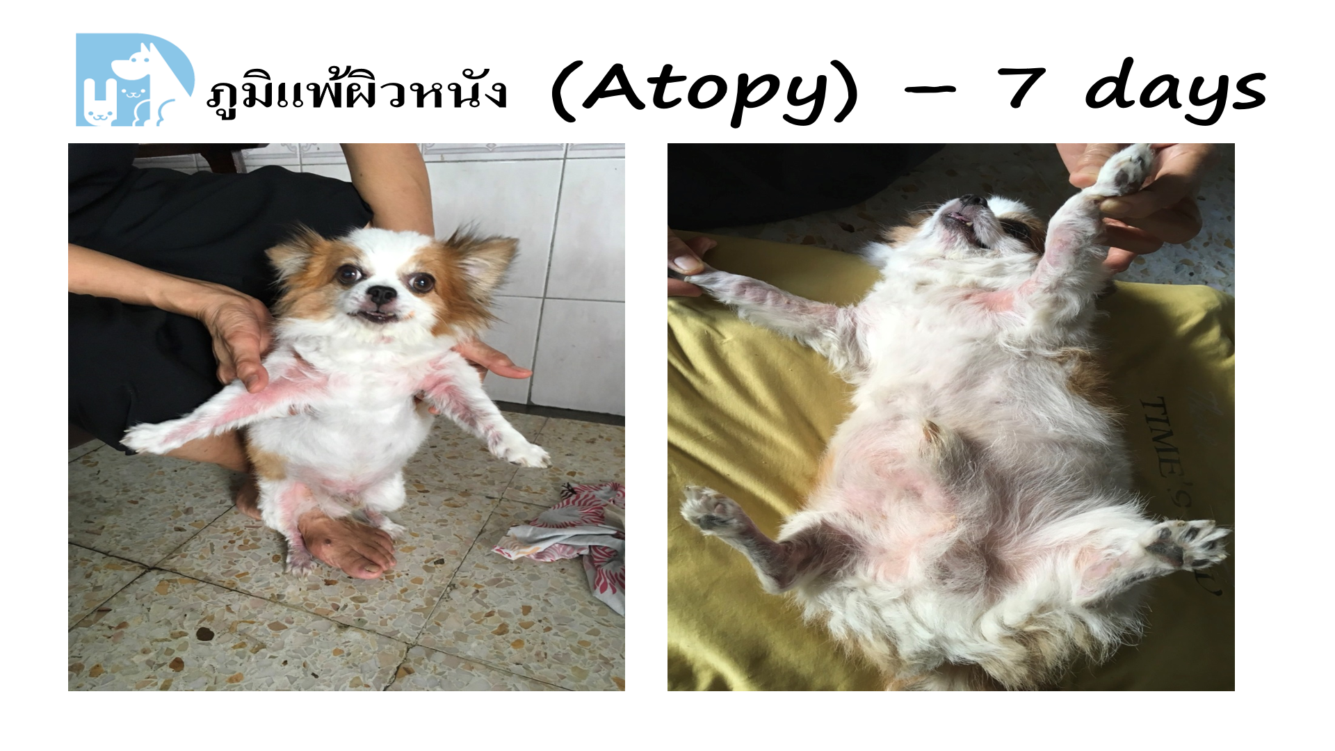 ภูมิแพ้ผิวหนัง Atopy ก่อน/หลัง